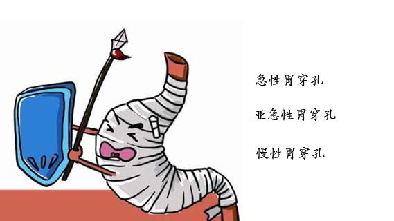 胃穿孔是什么原因造成的