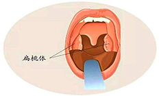 瘦!并不是人人都健康