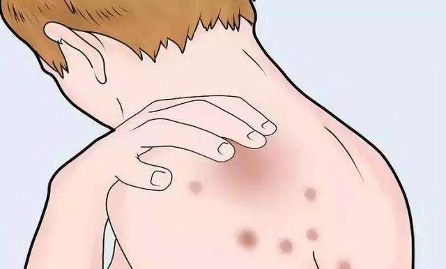 \