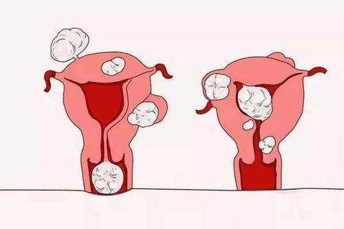 女孩下面突然出现了血丝