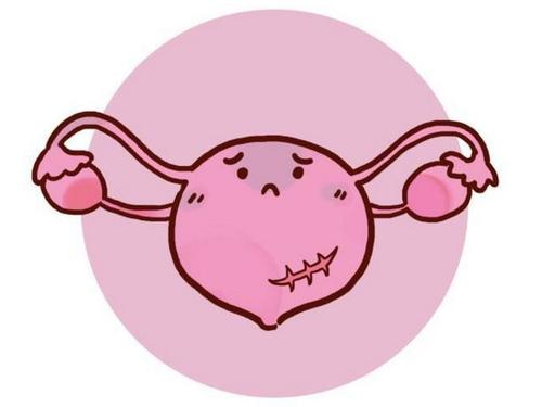 女孩患上子宫肌**，不知所措