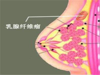 被嘲笑，养成了束胸的习惯
