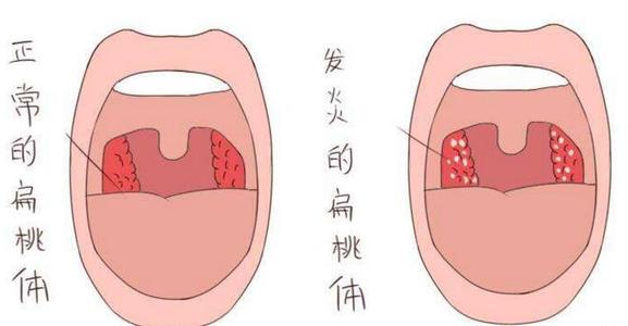 拉萨治疗扁桃体炎好的医院